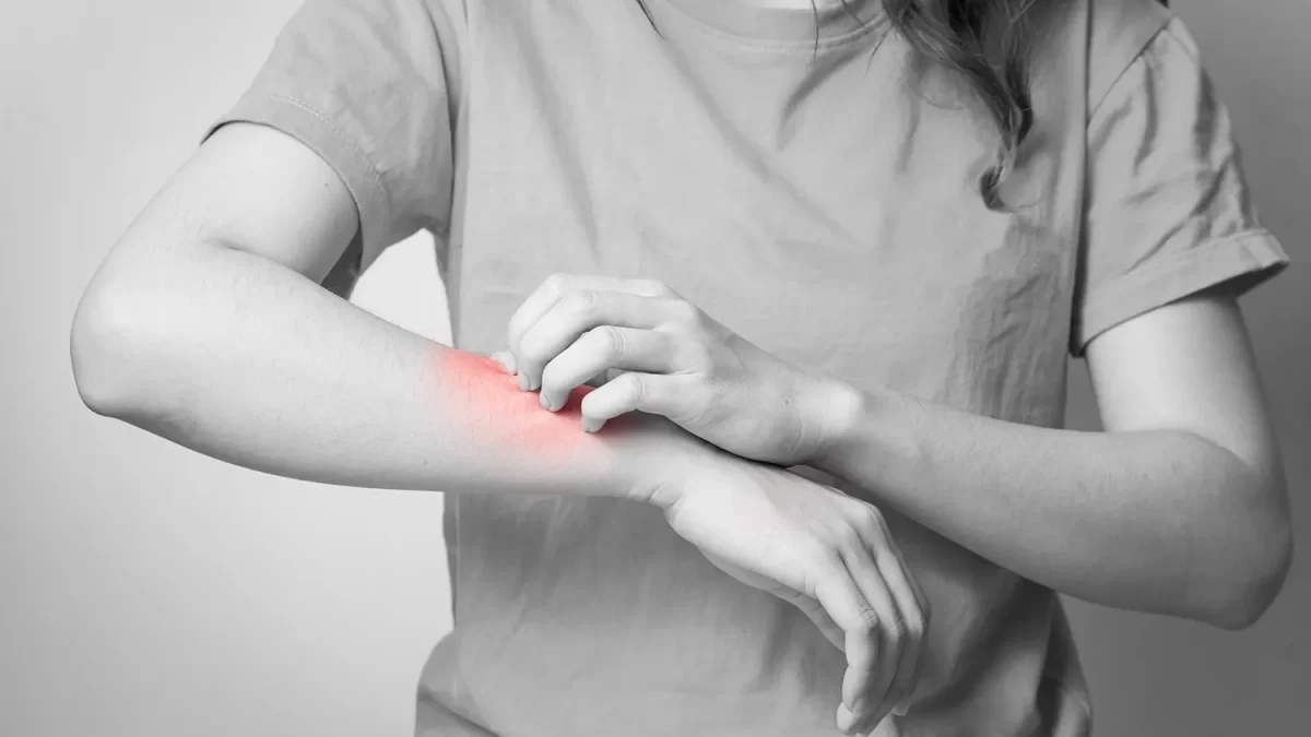 花粉症で体までかゆい時。目や鼻の薬と一緒に、眼科で「体のかゆみ」の相談はできる？